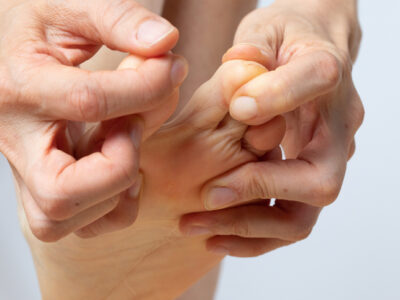 Man with symptoms of hammertoe