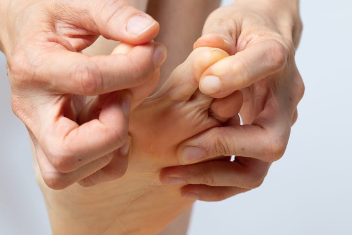 Man with symptoms of hammertoe