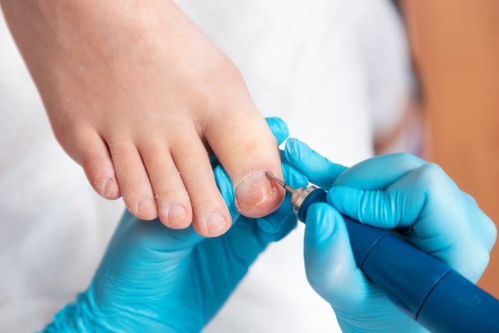 Close-up of an older adult's foot highlighting the importance of regular foot care.