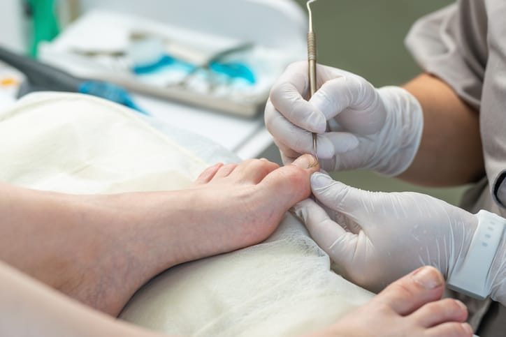 Podiatrist treating an ingrown toenail
