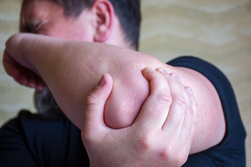 Man with pins and needles in his elbow